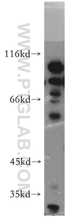 UIMC1 Antibody in Western Blot (WB)