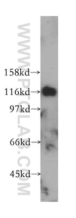 PCDH1 Antibody in Western Blot (WB)
