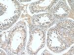 CST9L Antibody in Immunohistochemistry (Paraffin) (IHC (P))
