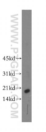 CST9L Antibody in Western Blot (WB)