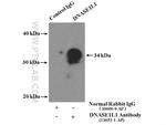 DNASE1L1 Antibody in Immunoprecipitation (IP)