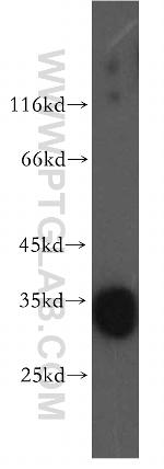 DNASE1L1 Antibody in Western Blot (WB)