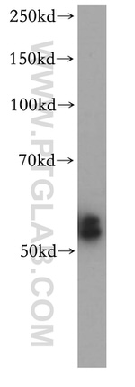 CYP2S1 Antibody in Western Blot (WB)