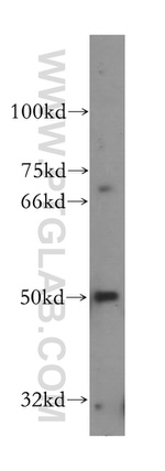 NR2C1 Antibody in Western Blot (WB)