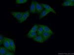 GART Antibody in Immunocytochemistry (ICC/IF)