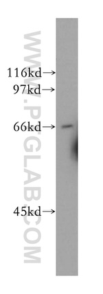 CDC14A Antibody in Western Blot (WB)