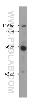 CDC14A Antibody in Western Blot (WB)
