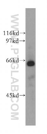 CDC14A Antibody in Western Blot (WB)