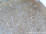 CRMP4 Antibody in Immunohistochemistry (Paraffin) (IHC (P))
