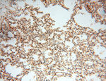LTA4H Antibody in Immunohistochemistry (Paraffin) (IHC (P))