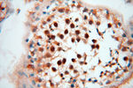 LTA4H Antibody in Immunohistochemistry (Paraffin) (IHC (P))