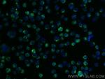 TRIM17 Antibody in Immunocytochemistry (ICC/IF)