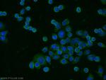 TRIM17 Antibody in Immunocytochemistry (ICC/IF)