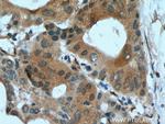 TRIM17 Antibody in Immunohistochemistry (Paraffin) (IHC (P))