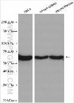 TRIM17 Antibody in Western Blot (WB)