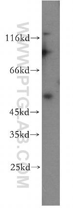 TRIM17 Antibody in Western Blot (WB)