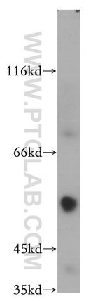 TRIM17 Antibody in Western Blot (WB)