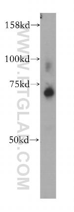 ZNF443 Antibody in Western Blot (WB)