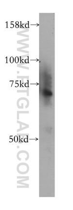 ZNF443 Antibody in Western Blot (WB)