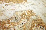 ATP11B Antibody in Immunohistochemistry (Paraffin) (IHC (P))