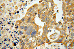 ATP11B Antibody in Immunohistochemistry (Paraffin) (IHC (P))