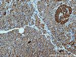 SEC24D Antibody in Immunohistochemistry (Paraffin) (IHC (P))
