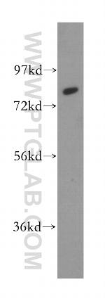 Calpain 11 Antibody in Western Blot (WB)