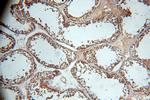 WDR1 Antibody in Immunohistochemistry (Paraffin) (IHC (P))