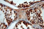 WDR1 Antibody in Immunohistochemistry (Paraffin) (IHC (P))