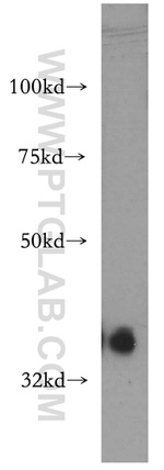 PIGA Antibody in Western Blot (WB)