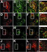 Transferrin Receptor Antibody in Immunocytochemistry (ICC/IF)