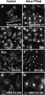 Transferrin Receptor Antibody in Immunocytochemistry (ICC/IF)