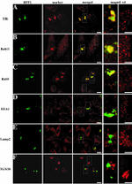 Transferrin Receptor Antibody in Immunocytochemistry (ICC/IF)