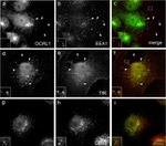 Transferrin Receptor Antibody in Immunocytochemistry (ICC/IF)
