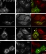 Transferrin Receptor Antibody in Immunocytochemistry (ICC/IF)