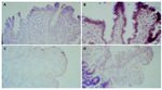 Transferrin Receptor Antibody in Immunohistochemistry (Paraffin) (IHC (P))