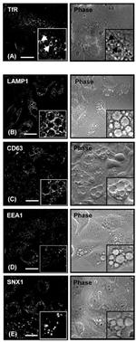 Transferrin Receptor Antibody in Immunocytochemistry (ICC/IF)