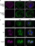 Transferrin Receptor Antibody in Immunocytochemistry (ICC/IF)
