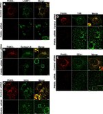 Transferrin Receptor Antibody in Immunocytochemistry (ICC/IF)