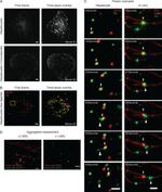 Transferrin Receptor Antibody in Immunocytochemistry (ICC/IF)