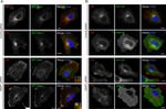 Transferrin Receptor Antibody in Immunocytochemistry (ICC/IF)