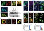 Transferrin Receptor Antibody in Immunocytochemistry (ICC/IF)