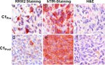 Transferrin Receptor Antibody in Immunohistochemistry (IHC)