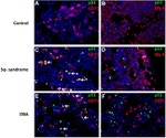 Transferrin Receptor Antibody in Immunocytochemistry (ICC/IF)