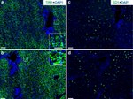 Transferrin Receptor Antibody in Immunohistochemistry (IHC)