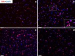 Transferrin Receptor Antibody in Immunohistochemistry (IHC)
