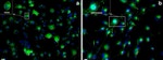 Transferrin Receptor Antibody in Immunocytochemistry (ICC/IF)