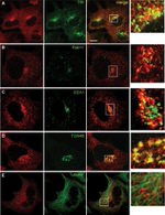 Transferrin Receptor Antibody in Immunocytochemistry (ICC/IF)