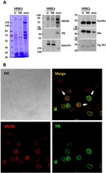 Transferrin Receptor Antibody in Western Blot, Immunocytochemistry (WB, ICC/IF)
