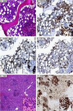 Transferrin Receptor Antibody in Immunohistochemistry (IHC)